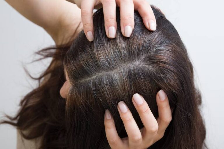 5 alimenti che possono prevenire i capelli grigi