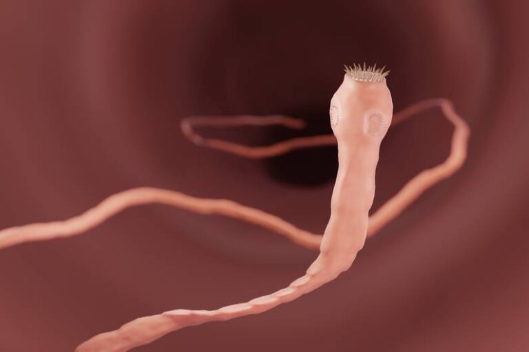 Tenia nell’uomo: cause, sintomi e trattamento